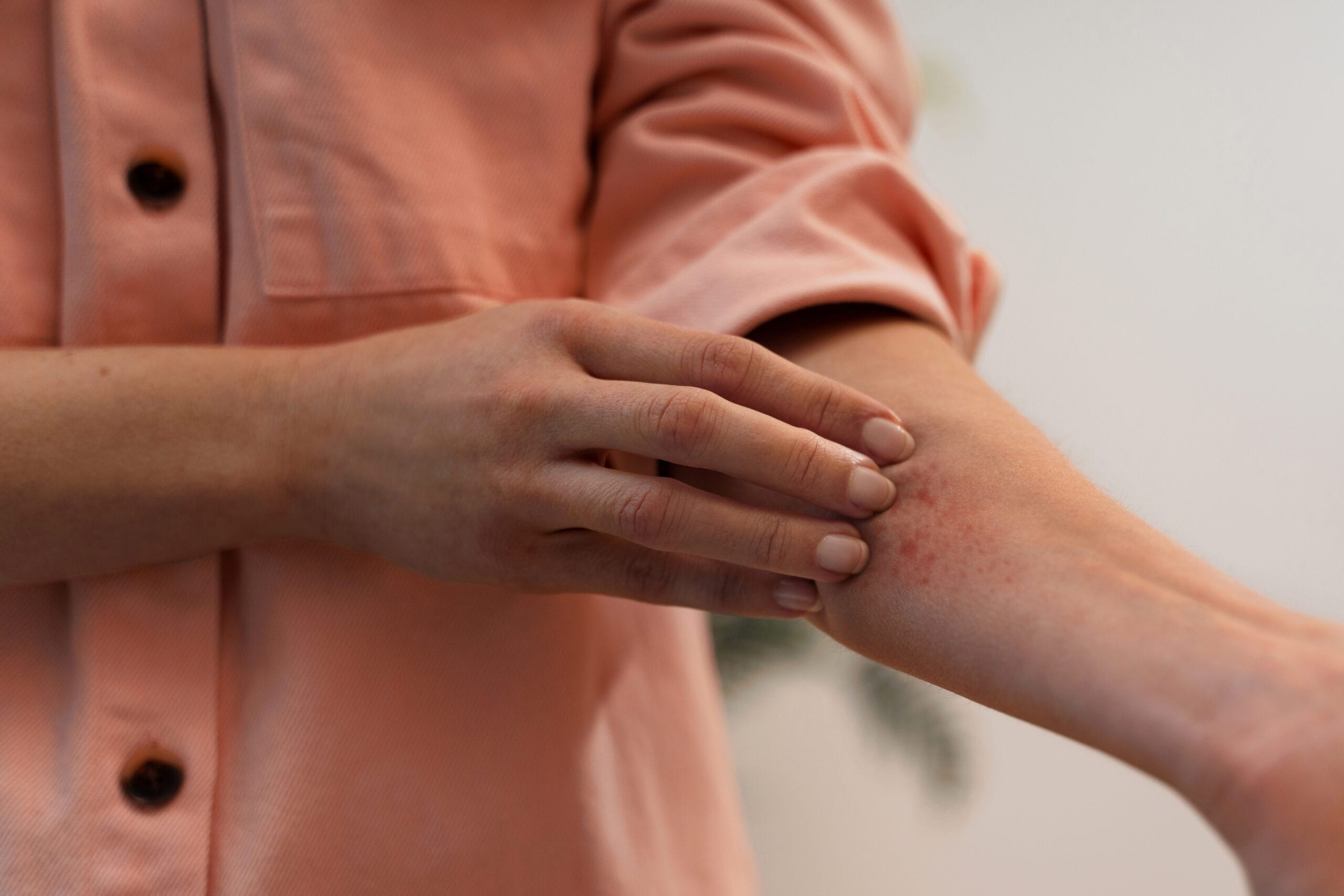 Close-up of a person scratching a red, irritated rash on the inner forearm while wearing a light pink long-sleeved shirt.