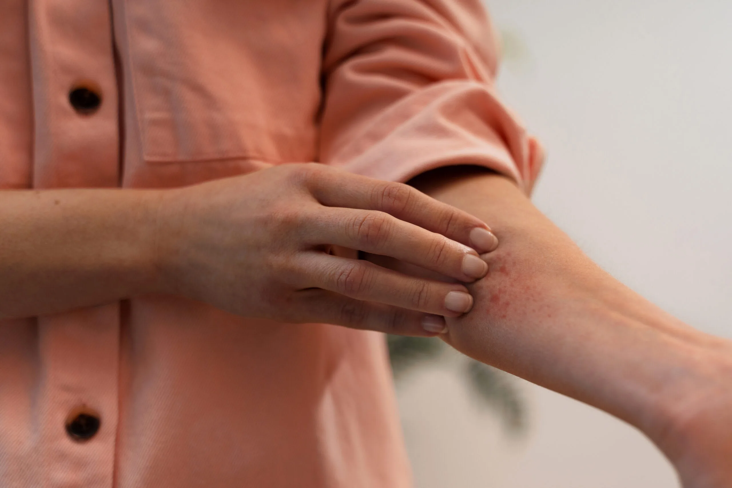 Close-up of a person scratching a red, irritated rash on the inner forearm while wearing a light pink long-sleeved shirt.